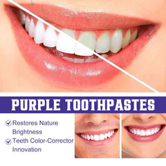 Purple Teeth Whitening Cleaning